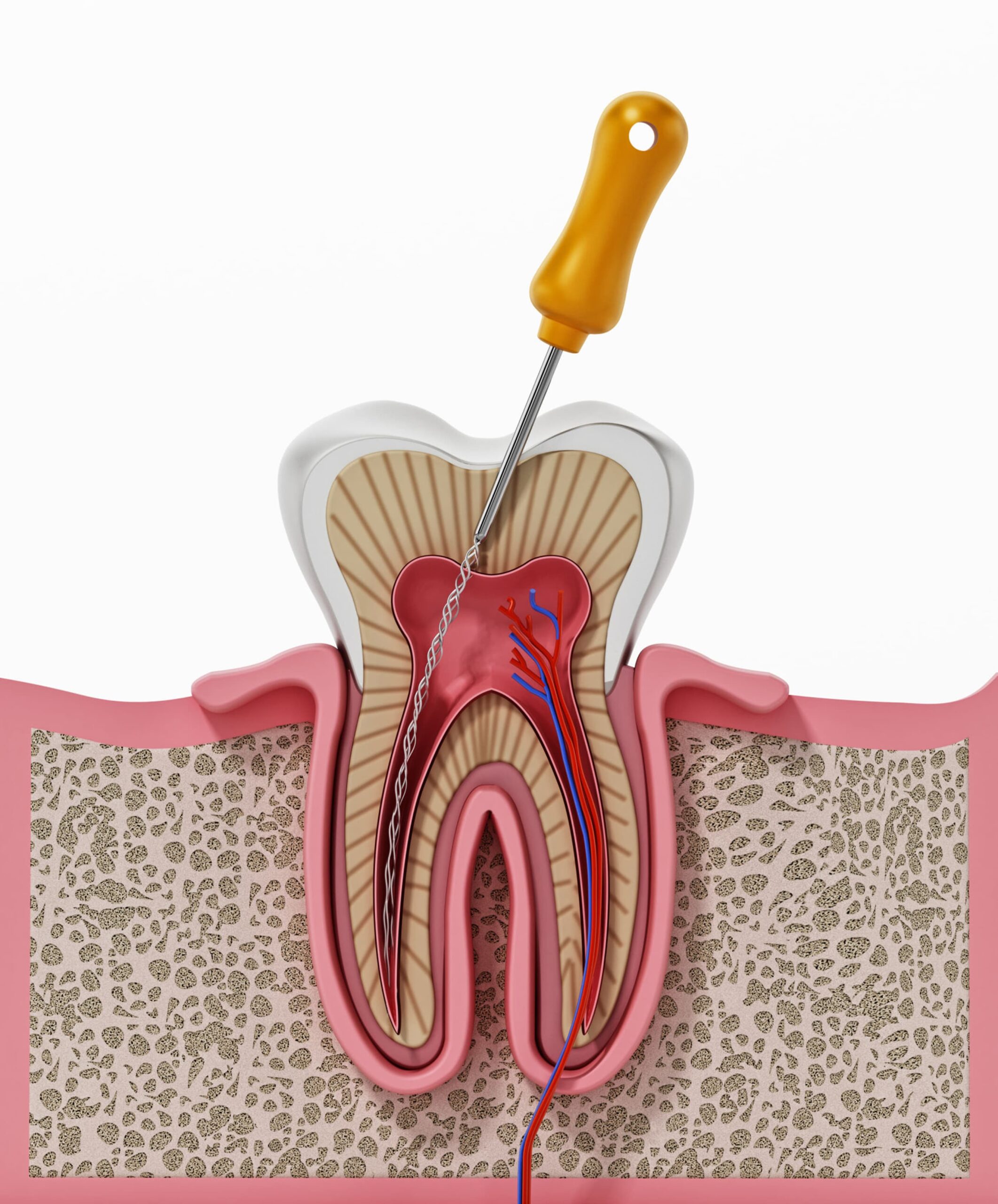 Dental Treatment